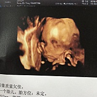 各位孕妈，看看是男宝还是女宝