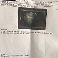 今天又有流血 好害怕 吃完中饭就赶紧去医院  医生在午休 挂了急诊  抽血化验 明天才能领结果  彩超显示...