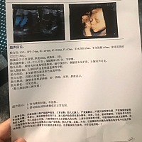 都说是男孩有会看的吗、希望是女孩👧