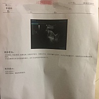 今天流血了去医院检查说流产了，说我年轻不建议保胎，说宝宝发育也不好6周了才米粒大小，让宝宝自然流掉...