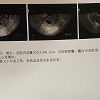 这是41天的时候拍的，有谁能看出来男宝还是女宝呀？