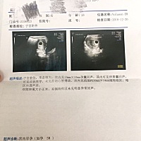 2018年11月7号大姨妈最后的开始时间，孕6周，有轻微出血，去医院检查做B超有积液，医生开了黄体酮和维E...