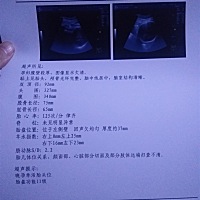 38 6了，好快呀，有没有差不多的