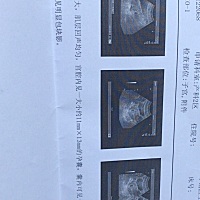 怀孕初期5周➕5！b超显示未见明显胚芽回声，有点担心。有经验者的宝妈能告诉一下吗？本人在不知道知道怀...