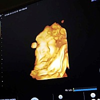 宝儿 能发动了吧 还要呆多久啊 每天累死了 耻骨疼死了 😭