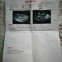 婚前没有过性生活，月经一直有推后几天的习惯，现在婚后半年没怀孕。上个月12号来的月经，现在还没有来...