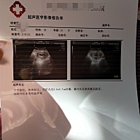 九周了，检查三次了只有孕囊，什么都没看到，怎么办，好难过