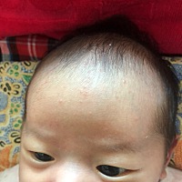 这是湿疹还是热的。马上满月了，脖子上也有一点