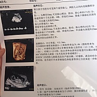 头胎公主顺产，二胎双胞胎， 跪求腹中健康龙凤胎，有经验的帮忙看看，