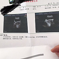 我的末次月事是10月26日，12月5日试纸测有孕，12月6日医院抽血确诊怀孕，每周检查一次，HCG和孕酮正常，...