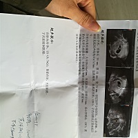 有人会看吗，医生说我这想流产，严重吗？