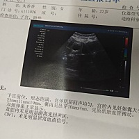 宝妈们，我看你上面说都能看出来男孩子女孩子啊，我也来一张