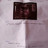 不孕，大家帮忙看看，我下面该怎么办