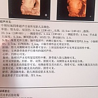 四维 医生说宝宝头大 有做四维宝宝头大的吗？ 正常吗。