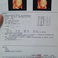 四维顺利通过！