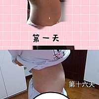 剖腹产第50天，孕期肚子真的超级大，导致生完肚子还跟怀孕四五个月一样，还好现在有在慢慢恢复，