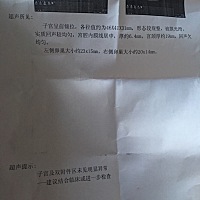 11月6日自然流产12月1日来的第一次月经 今天去查一下恢复情况 B超的结果 医生说恢复挺好 可是内膜不薄么...
