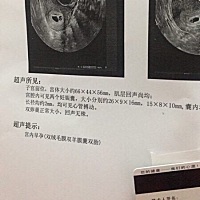 能不能看出来性别？