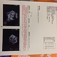b超单一张，能看出男女吗