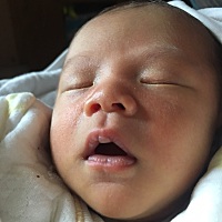 宝宝的嘴巴👄这是怎么了 出生第10天，黄疸还没有退去 喝奶能喝60-90ml左右