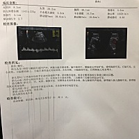 怎么算宝宝的体重？宝宝的头算大吗？臀股长才5.5是不是腿短呀？好纠结啊…希望是女宝宝…