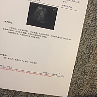 现在怀孕50天了，两次抽血结果都是孕酮低，HCG翻倍还行，也不知道往后还会不会继续翻倍，现在在补孕酮，...