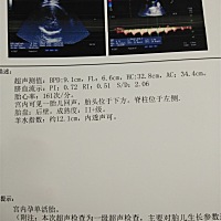 哪位大神帮我看看，医生说偏小一周。预产期还有10天了。有影响吗？