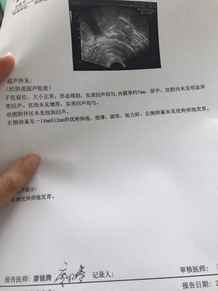 今天监测的 希望这个月好孕啊 拜托拜托🙏🙏