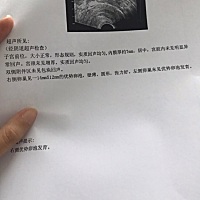 今天监测的 希望这个月好孕啊 拜托拜托🙏🙏