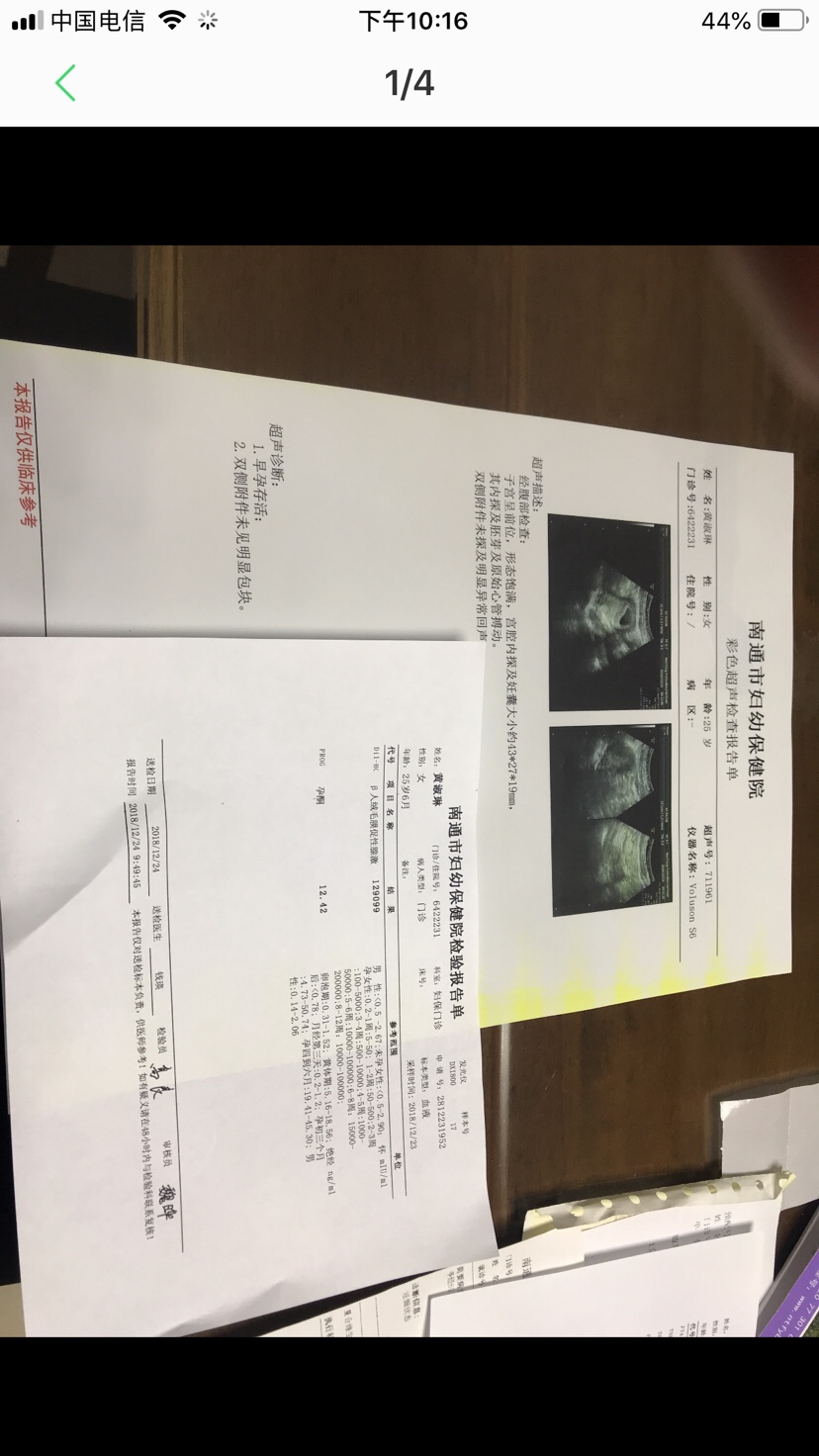 加油加油 刚去查 明天去建档