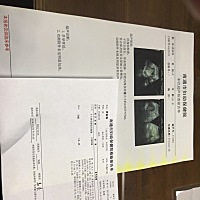 加油加油 刚去查 明天去建档