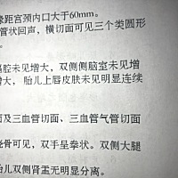 听说这样是女孩子这个准吗，双测肾无明显分离