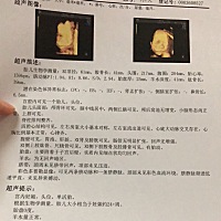 自从知道怀孕就没去上班了，前期怀孕没有一点感觉，去医院做四维回来，朋友都说我的绝对是男孩，老一辈...