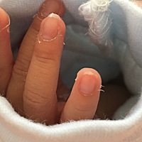 16天宝宝的指甲，经常自己刮到自己的脸，我想剪短，但又怕剪到肉。宝妈们你们宝宝也有这种情况吗？