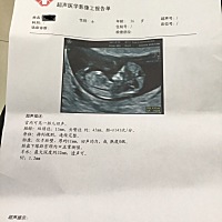 宝宝比较配合，nt 很顺利。专业人士可以看男女吗？