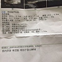 12周做了NT检查，大家觉得是男宝还是女宝呢？😄