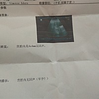 请问各位有经验的宝妈们，，末次月经11月7号，12月19去做过一次b超，医生说时间太短只能看见一个小黑点...