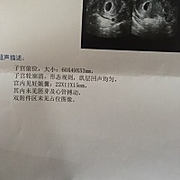 末次月经11月6号 同床时间11月13号左右 12月26检查没有胎心胎芽正常吗