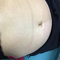 现在14周➕2能看的出男女不，第一胎男宝，