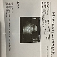 看B超单猜男女，有经验的帮忙猜下吧😄 7周+ 孕囊37×24×28.尿检PH值7.0