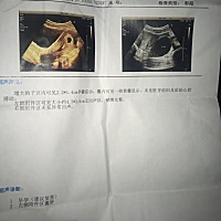 怀孕44天检查没有胚芽，这情况正常吗