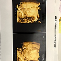 哪位亲会看帮忙看下是男宝还是女宝