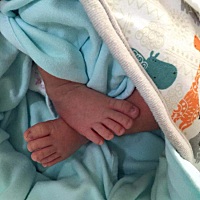 宝宝刚出生 脚拇指的指甲长成这样 宝妈们有见过这样的情况吗？ 它会自然长好吗？我跟他爸的指甲长得都很...