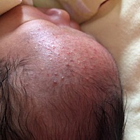 宝宝额头脸颊好多红点点，是湿疹吗？？ 可以抹润肤霜或者木瓜膏吗？？？？？