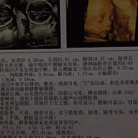 像男宝还是女宝！