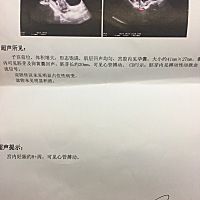 请有经验的宝妈帮我看看 检查报告 等我昨晚 医生已经下班了