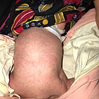 这是怎么回事有宝妈知道吗