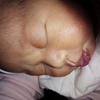 来迟了，来迟了，12月3日下午3点27分，顺转破，爱吃的男宝宝一枚，6斤4两，现已长到8斤5两~