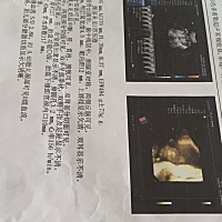 22周检查四维胎盘低，离宫内口10mm，怎么办？后期会长上来吗？