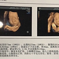 我滴小猪宝 好期待你的降临 孕期很辛苦但是你只要一动就感觉很幸福🥰 长的像我不知道是男孩女孩  但是...